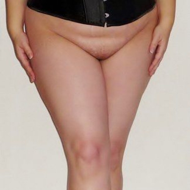 Plan cam avec femme obèse
 Freissenet